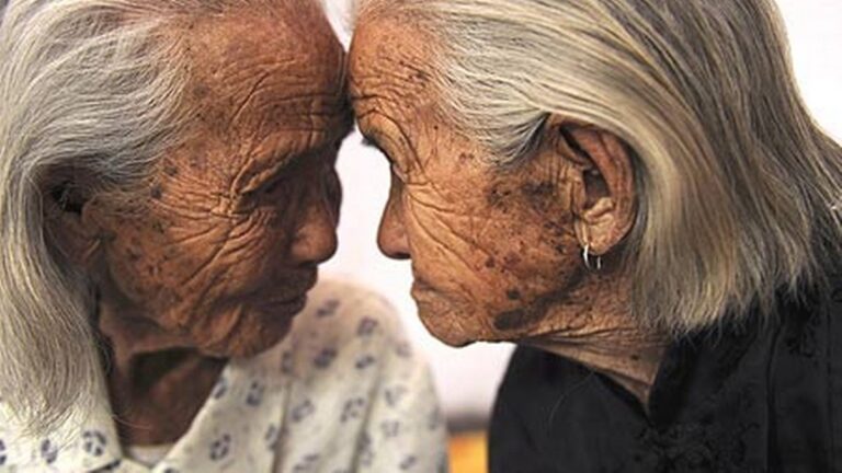 6 Oldest Recorded Twins in the World
